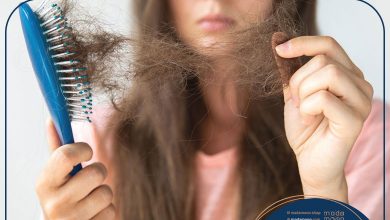 شایع‌ترین علل ریزش مو در خانم‌ها کدامند ؟