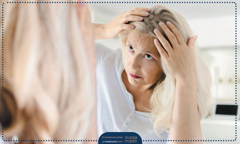 شایع‌ترین علل ریزش مو در خانم‌ها کدامند ؟