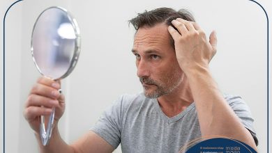 ریزش موی سکه‌ای چیست؟ و چطور درمان می‌شود؟ 